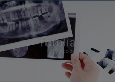歯周形成外科